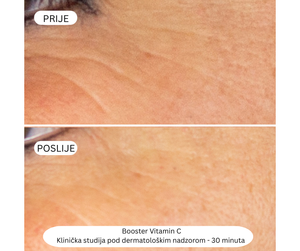 Rutina za blistav ten