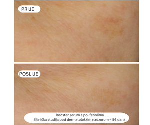 Booster Serum s Polifenolima - Protiv tamnih mrlja