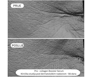 Mini Pro - Collagen Booster Serum