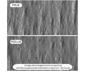Omega Ekstra bogata krema za oporavak