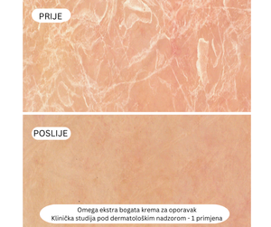 Omega Ekstra bogata krema za oporavak