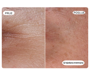Collagen +