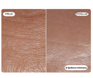 Collagen +