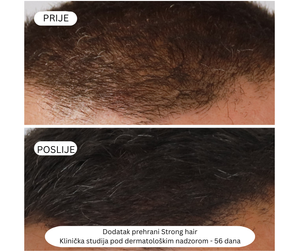 Strong hair - Snažna kosa