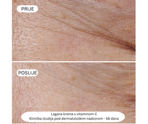 Rutina za blistav ten