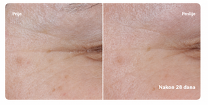 MINI Booster Serum s vitaminom C, 30% stabilizirani vitamin C