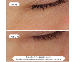 Pro-Retinol paket