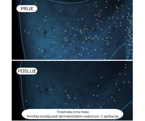 Trostruko crna maska