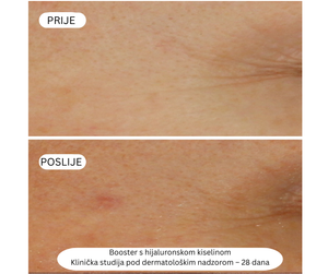 Mini Booster Serum s hijaluronskom kiselinom