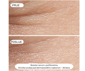 Booster Serum s Polifenolima - Protiv tamnih mrlja