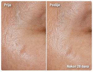 MINI Booster Serum s vitaminom C, 30% stabilizirani vitamin C