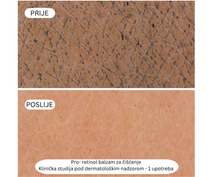Paket za čišćenje Pro – Retinol