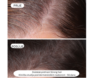 Strong hair - Snažna kosa